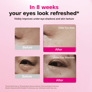 ISOI Blemish Care Eye & Wrinkle Patch (90g)